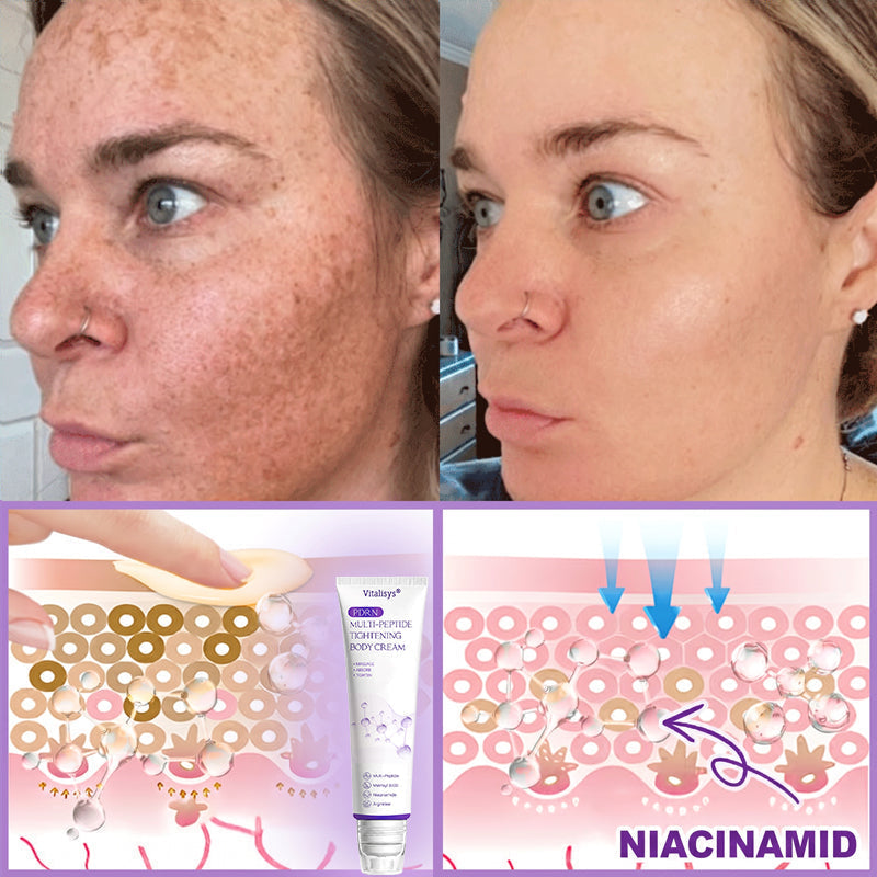 Enjoy an exclusive 30% discount:Vitalisys® 🍈PDRN Multi-Peptide Massaging Body Roller Cream- Anti-aging, Hydrating, Skin Firming & Lifting, Skin Repair, Even Tone, Acne and Dark Spot Treatment, Wart and Mole Removal, and Psoriasis Relief.