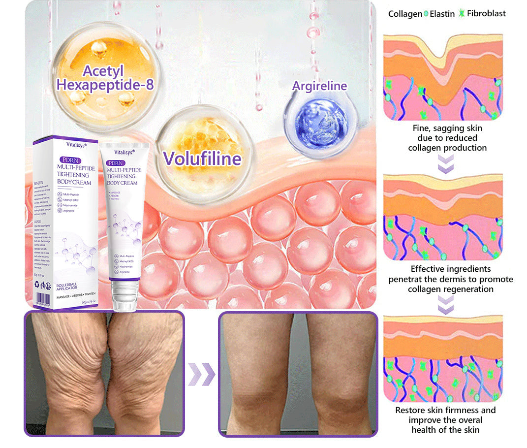 Enjoy an exclusive 30% discount:Vitalisys® 🍈PDRN Multi-Peptide Massaging Body Roller Cream- Anti-aging, Hydrating, Skin Firming & Lifting, Skin Repair, Even Tone, Acne and Dark Spot Treatment, Wart and Mole Removal, and Psoriasis Relief.