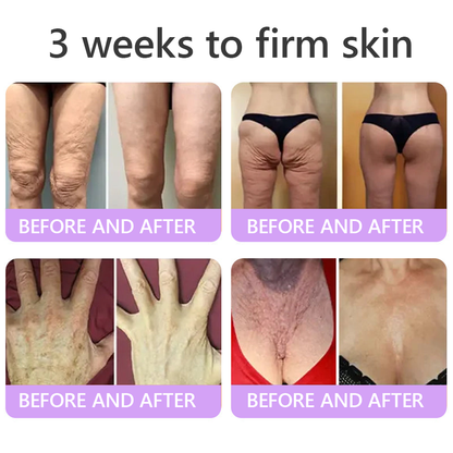 Enjoy an exclusive 30% discount:Vitalisys® 🍈PDRN Multi-Peptide Massaging Body Roller Cream- Anti-aging, Hydrating, Skin Firming & Lifting, Skin Repair, Even Tone, Acne and Dark Spot Treatment, Wart and Mole Removal, and Psoriasis Relief.