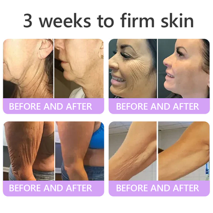 Enjoy an exclusive 30% discount:Vitalisys® 🍈PDRN Multi-Peptide Massaging Body Roller Cream- Anti-aging, Hydrating, Skin Firming & Lifting, Skin Repair, Even Tone, Acne and Dark Spot Treatment, Wart and Mole Removal, and Psoriasis Relief.