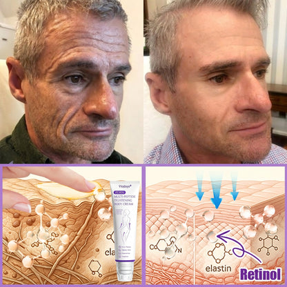 Enjoy an exclusive 30% discount:Vitalisys® 🍈PDRN Multi-Peptide Massaging Body Roller Cream- Anti-aging, Hydrating, Skin Firming & Lifting, Skin Repair, Even Tone, Acne and Dark Spot Treatment, Wart and Mole Removal, and Psoriasis Relief.